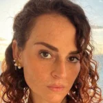 Kitzia Mitre / Cirugía mamaria y aplicació de botox.